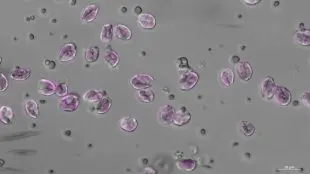 Mikroskopbild med alger.