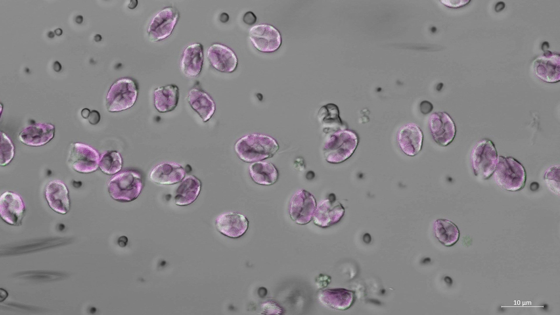 Mikroskopbild med alger.