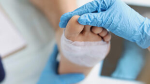 Patient med bandage runt del av foten.