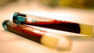 Två provrör med blod.