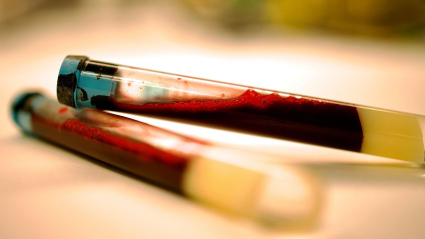 Två provrör med blod.