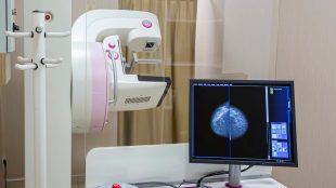 Röntgenutrustning vid mammografi och en datorbild över bröst.
