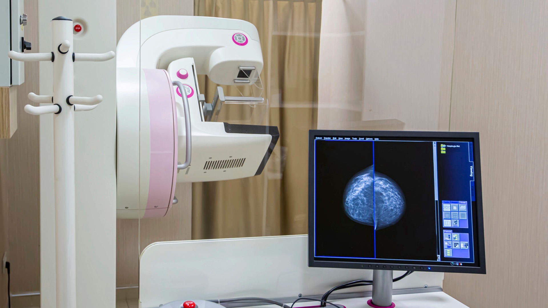 Röntgenutrustning vid mammografi och en datorbild över bröst.