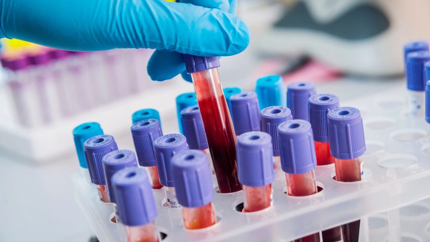 Rör med blodprov i labbmiljö.