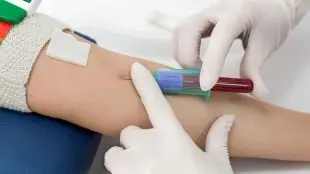 Blodprov tas på en patient