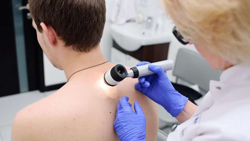 Hudundersökning av patients rygg
