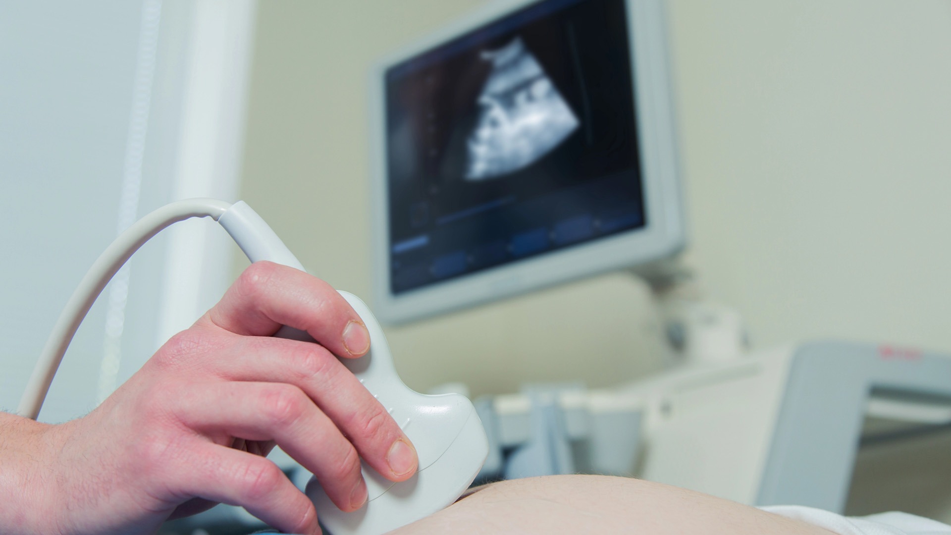 Gravid kvinna gör en ultraljudsundersökning där fostret syns på en skärm.